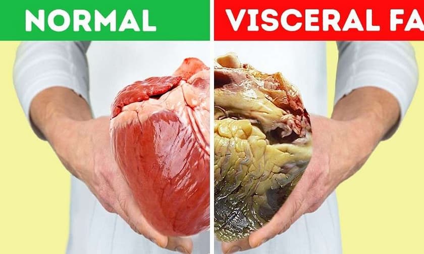The danger and causes of visceral fat! Visceral fat loss: 6 strategies